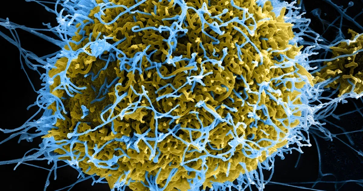 Új mRNS-vakcina fejlesztése az ebola legveszélyesebb törzsei ellen