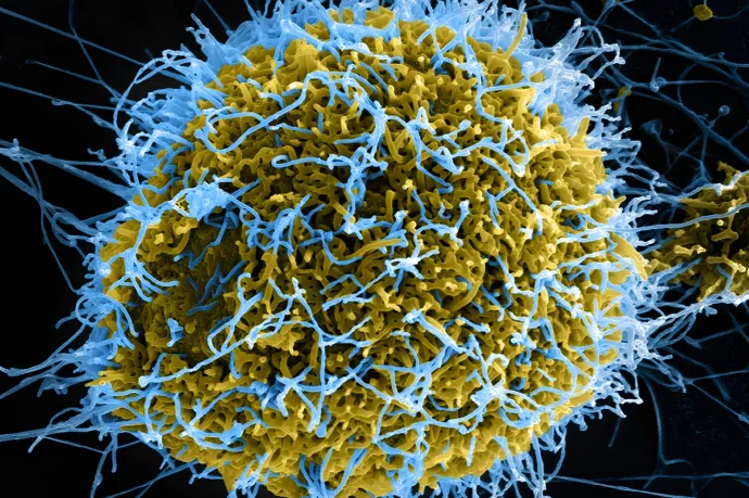Ígéretes eredményeket mutat az ebola legveszélyesebb vírustörzseire fejlesztett vakcina