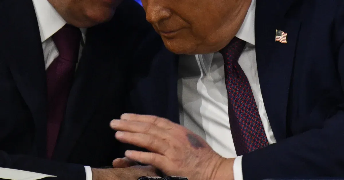 Trump egészségi állapota: Kissé javult, de továbbra is kérdések merülnek fel