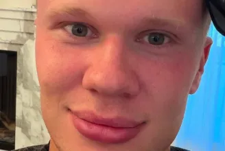 Haaland fél centisre nyíratta a védjegyének számító copfos haját