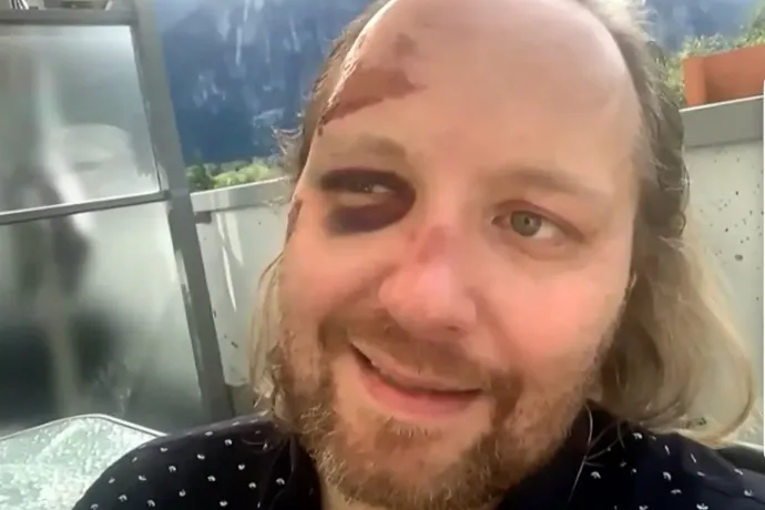 Eltört a sarka, gumicukron és hernyókon élt, de túlélte a hatnapos horrortúrát a kanadai vadonban