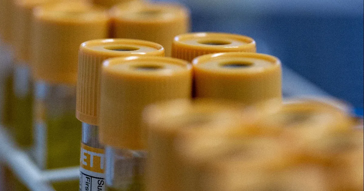 Pestisben halt meg egy szibériai pestisellenes laboratórium dolgozója, közel kétszáz kontaktját helyezték orvosi megfigyelés alá