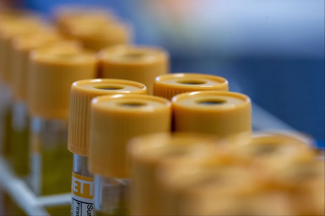 Pestisben halt meg egy szibériai pestisellenes laboratórium dolgozója, közel kétszáz kontaktját helyezték orvosi megfigyelés alá